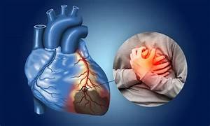 Heart Risk Starts Earlier in Men, Long-Term Study Shows