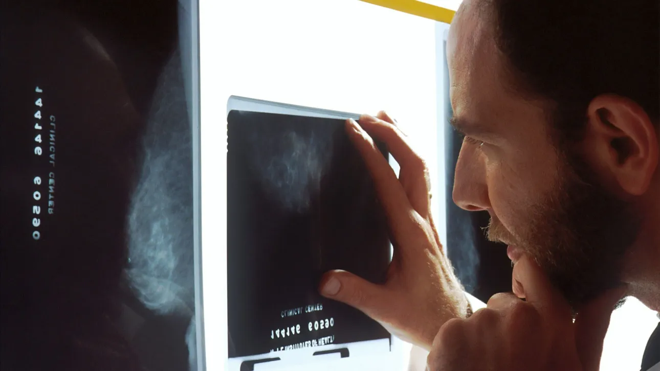 New Study: AI Could Detect Heart Disease Risk Through Routine Mammograms