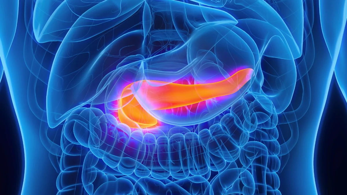 AI Detects Pancreatic Cancer Years Before Diagnosis, Study Finds