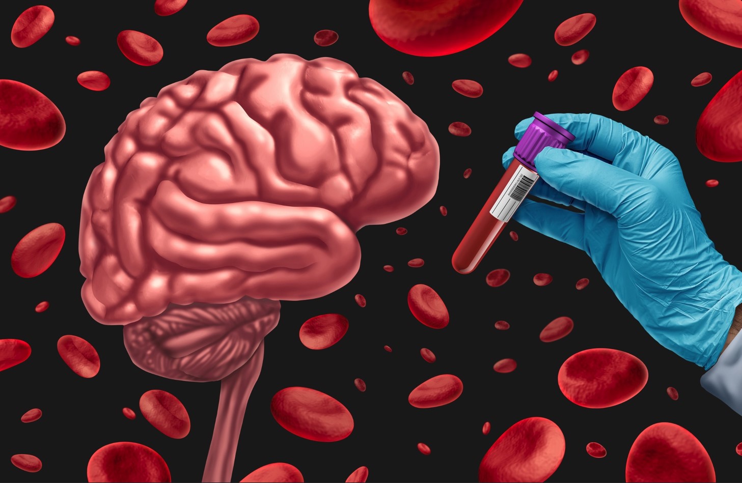 AI-Powered blood test may predict heart disease and stroke risk up to 15 years in advance