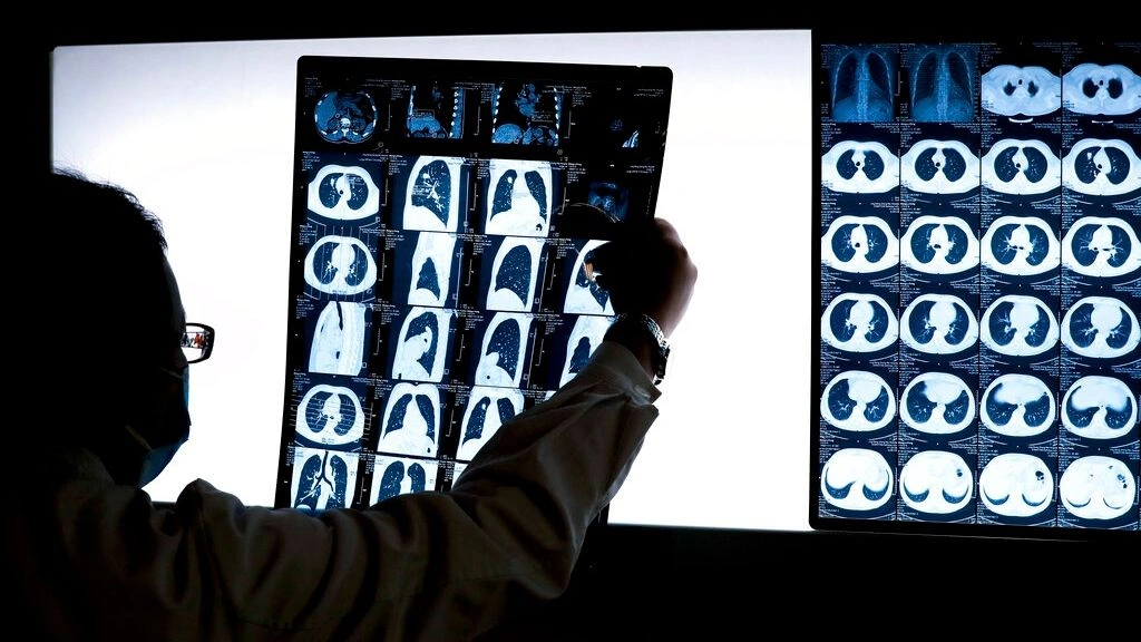Accelerated biological aging may explain the rise in cancer before 50, new study suggests