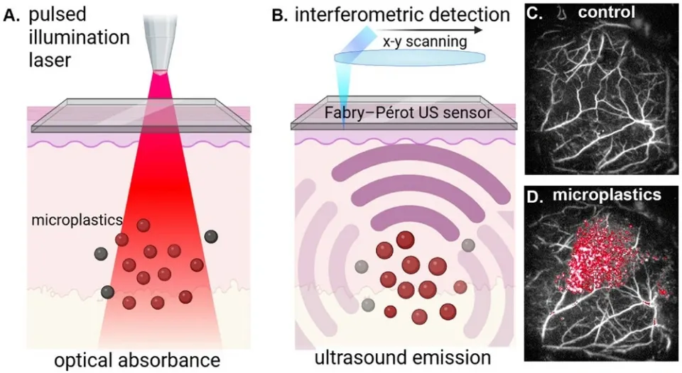 Laser-based imaging technique maps microplastics inside living organisms without surgery