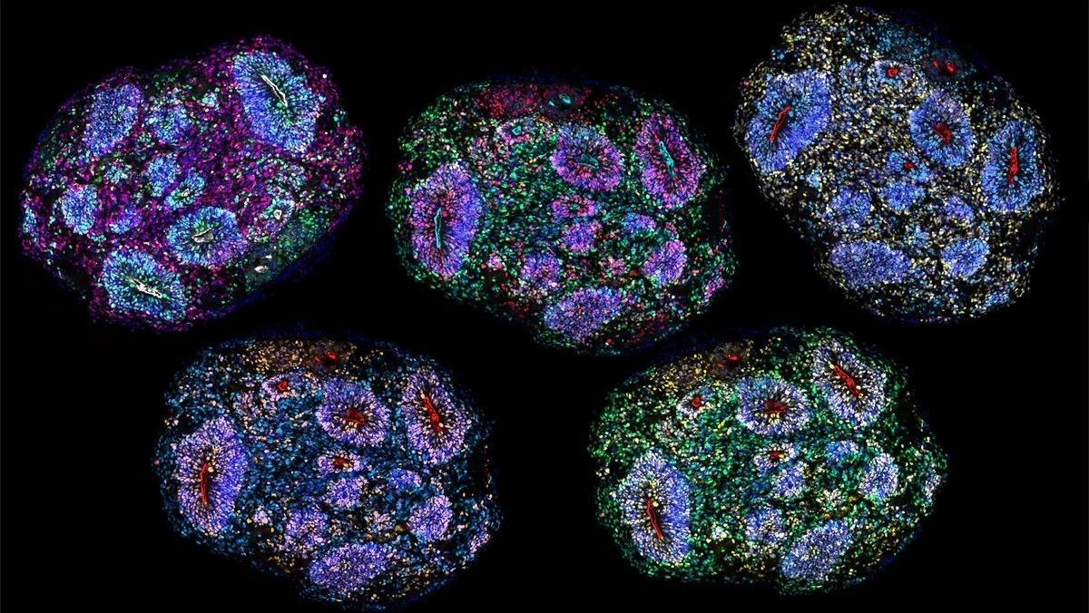 Scientists keep human brain organoids alive for five years